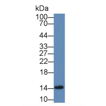 Fatty Acid Binding Protein 1 (FABP1) Mouse Polyclonal Antibody