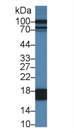 Fatty Acid Binding Protein 1 (FABP1) Pig Polyclonal Antibody