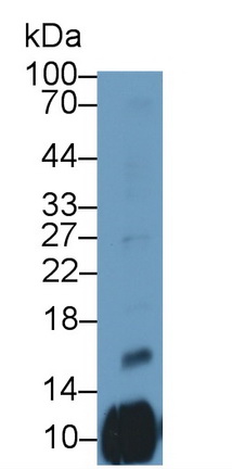 Platelet Factor 4 Variant 1 (PF4V1) Human Polyclonal Antibody
