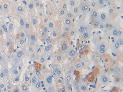 Thymus Activation Regulated Chemokine (TARC) Mouse Polyclonal Antibody