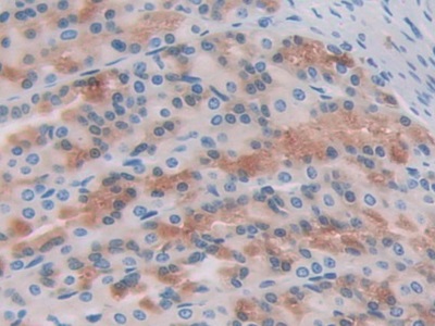 Thymus Activation Regulated Chemokine (TARC) Rat Polyclonal Antibody