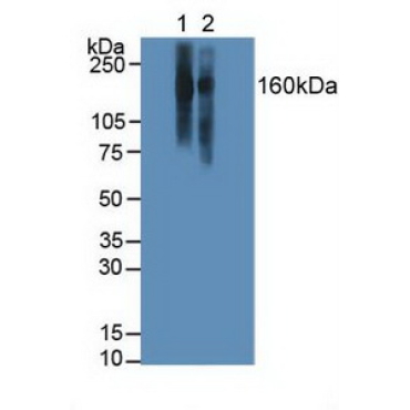 Lymphocyte Function Associated Antigen 1 Alpha (CD11a) Human Polyclonal Antibody