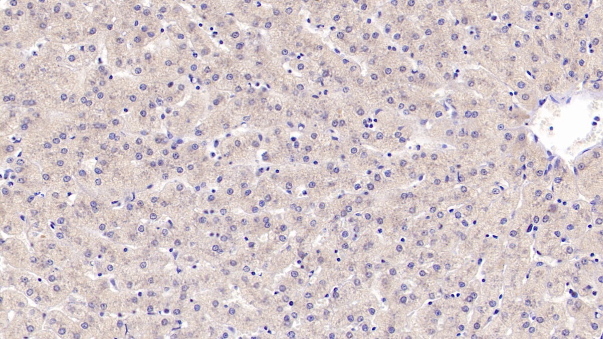 Myeloid Progenitor Inhibitory Factor 1 (MPIF1) Human Polyclonal Antibody