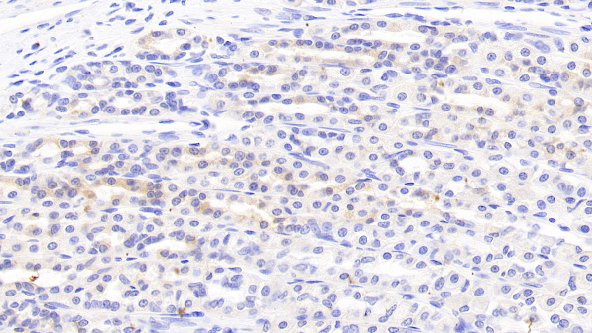 Secondary Lymphoid Tissue Chemokine (SLC) Rat Polyclonal Antibody