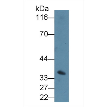 Cluster Of Differentiation 64 (CD64) Human Polyclonal Antibody