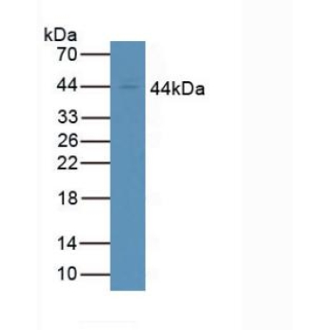 Cluster Of Differentiation 64 (CD64) Mouse Polyclonal Antibody