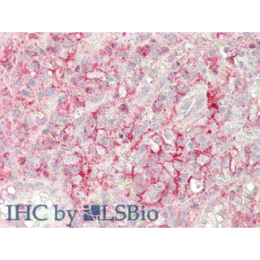 Cluster Of Differentiation 32 (CD32) Human Polyclonal Antibody