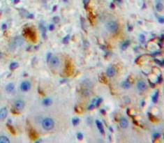 Cluster Of Differentiation 32 (CD32) Rat Polyclonal Antibody