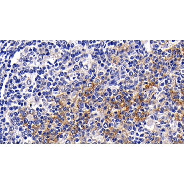 Cluster Of Differentiation 23 (CD23) Human Polyclonal Antibody