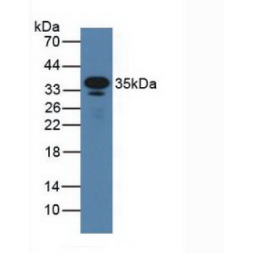 Cluster Of Differentiation 23 (CD23) Mouse Polyclonal Antibody
