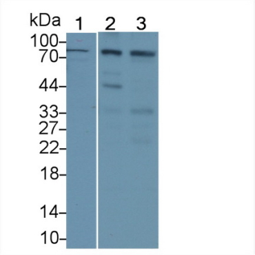 Integrin Beta 2 (CD18) Human Polyclonal Antibody