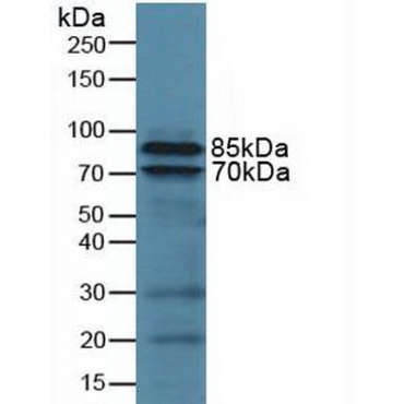 Integrin Beta 2 (CD18) Human Polyclonal Antibody
