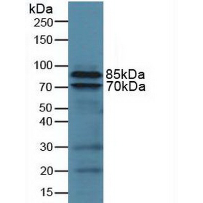 Integrin Beta 2 (CD18) Human Polyclonal Antibody