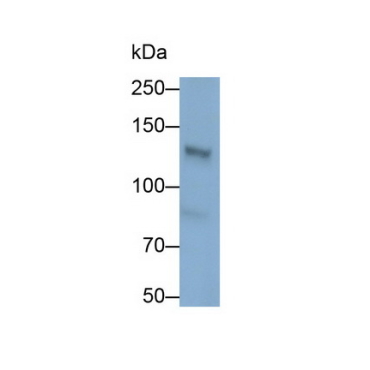 Palladin (PALLD) Human Polyclonal Antibody