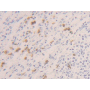 Caspase 1 (CASP1) Human Polyclonal Antibody