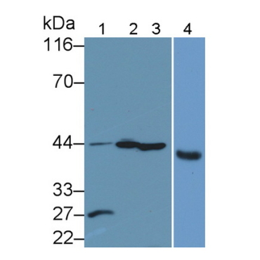 Caspase 1 (CASP1) Human Polyclonal Antibody