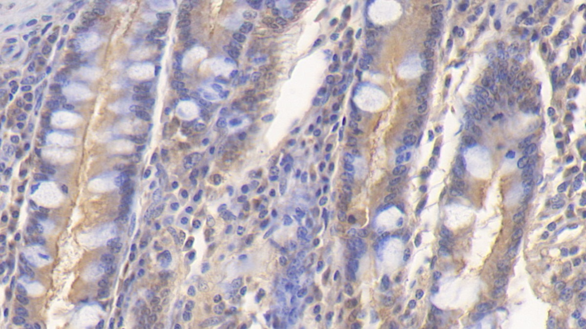 Cluster Of Differentiation 164 (CD164) Human Polyclonal Antibody