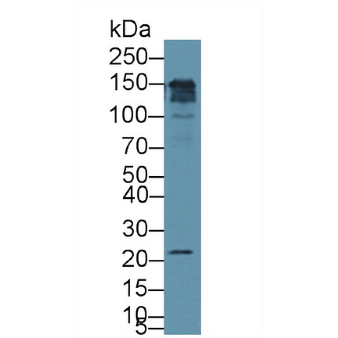 Cluster Of Differentiation 164 (CD164) Mouse Polyclonal Antibody