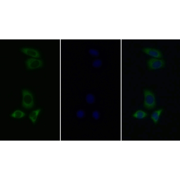 Tyrosine Kinase 2 (Tyk2) Human Polyclonal Antibody