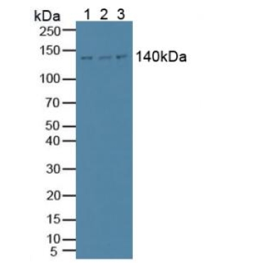 Phospholipase C Beta 1 (PLCB1) Human Polyclonal Antibody