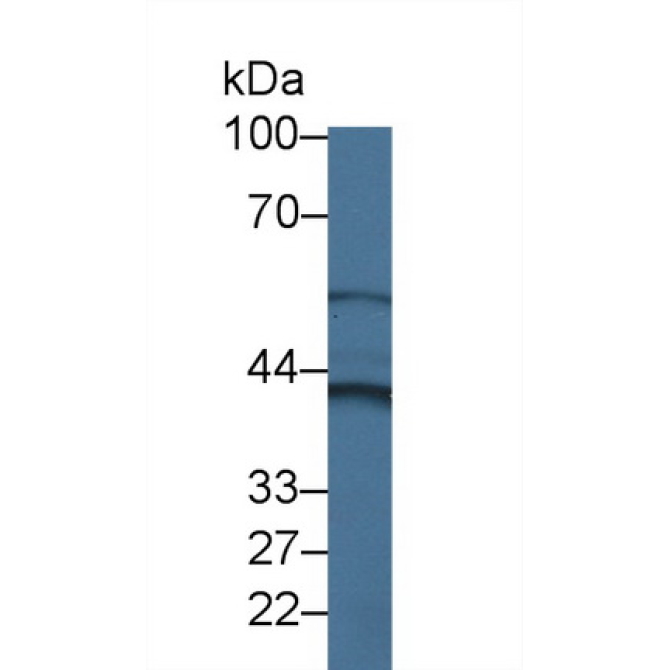 Cytohesin 4 (CYTH4) Human Polyclonal Antibody