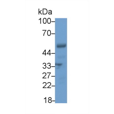 Interferon Regulatory Factor 5 (IRF5) Human Polyclonal Antibody