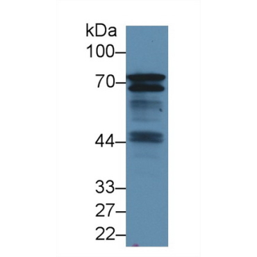B-Cell Linker Protein (BLNK) Human Polyclonal Antibody