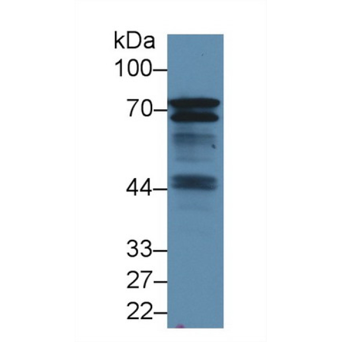 B-Cell Linker Protein (BLNK) Human Polyclonal Antibody