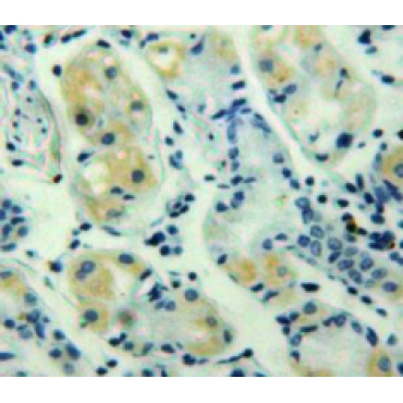 Chemokine (C-X-C Motif) Ligand 3 (CXCL3) Human Polyclonal Antibody