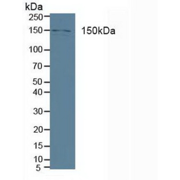 Phospholipase C Beta 3, Phosphoinositide Specific (PLCb3) Human Polyclonal Antibody