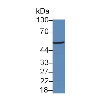 Glucocorticoid Receptor (GR) Human Polyclonal Antibody
