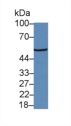 Glucocorticoid Receptor (GR) Human Polyclonal Antibody