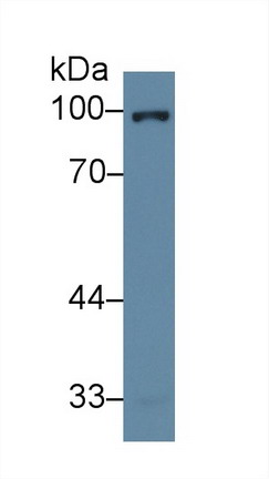 Glucocorticoid Receptor (GR) Human Polyclonal Antibody