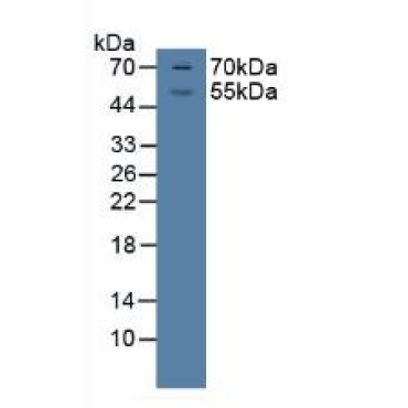 Glucocorticoid Receptor (GR) Human Polyclonal Antibody