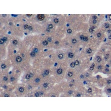 Glucocorticoid Receptor (GR) Mouse Polyclonal Antibody
