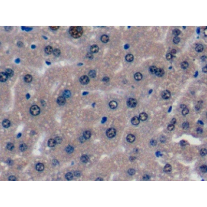 Glucocorticoid Receptor (GR) Mouse Polyclonal Antibody