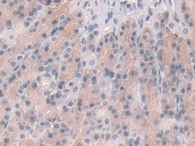 Glucocorticoid Receptor (GR) Rat Polyclonal Antibody