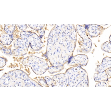Neuraminidase (NEU) Human Polyclonal Antibody