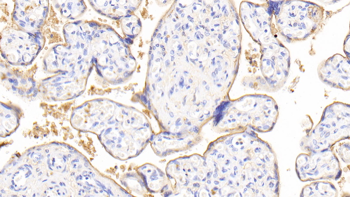 Neuraminidase (NEU) Human Polyclonal Antibody