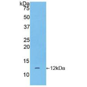 Chorionic Gonadotropin Alpha Polypeptide (CGa) Human Polyclonal Antibody