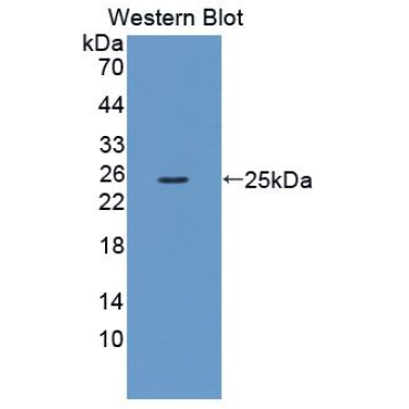 Coagulation Factor XIII B Polypeptide (F13B) Mouse Polyclonal Antibody