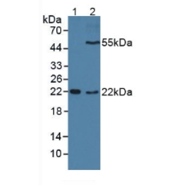 Cluster Of Differentiation 209 (CD209) Human Polyclonal Antibody