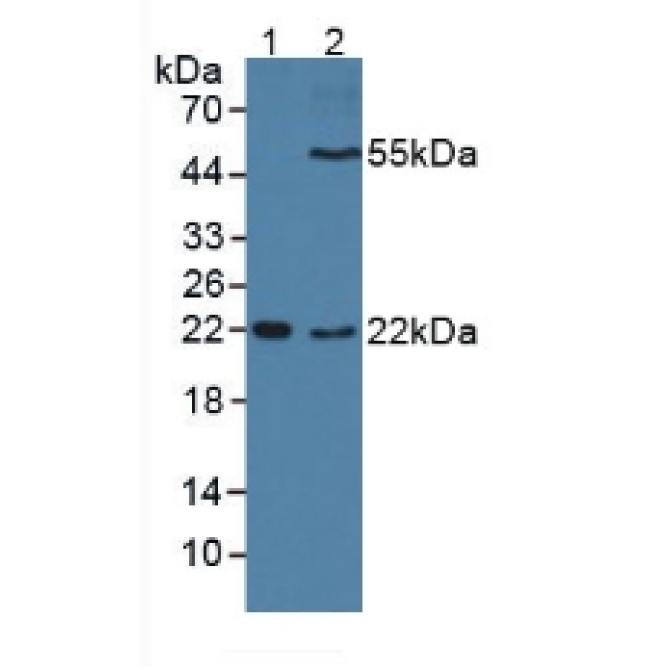 Cluster Of Differentiation 209 (CD209) Human Polyclonal Antibody