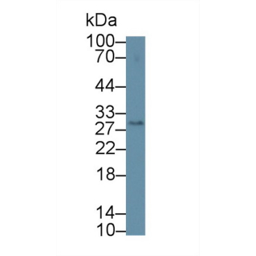 Cluster Of Differentiation 209 (CD209) Mouse Polyclonal Antibody