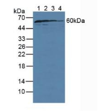 GDP Dissociation Inhibitor 1 (GDI1) Human Polyclonal Antibody