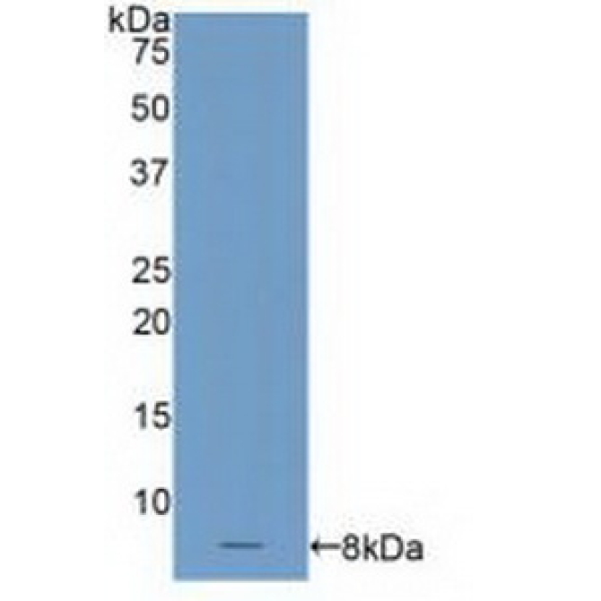 C4 Binding Protein Alpha (C4BPa) Human Polyclonal Antibody