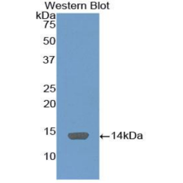 C4 Binding Protein Alpha (C4BPa) Mouse Polyclonal Antibody