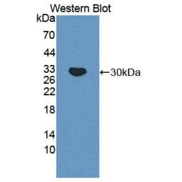 C4 Binding Protein Alpha (C4BPa) Mouse Polyclonal Antibody