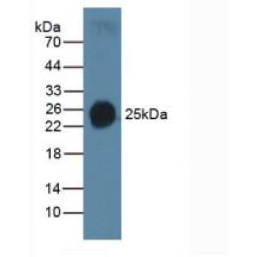 Surfactant Protein C (SP-C) Human Polyclonal Antibody