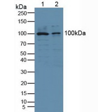 Cytosolic Phospholipase A2 (PLA2G4) Human Polyclonal Antibody